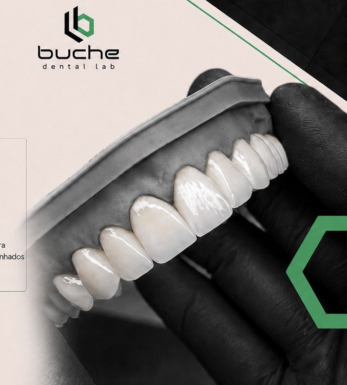 Prótese odontológica com acabamento refinado